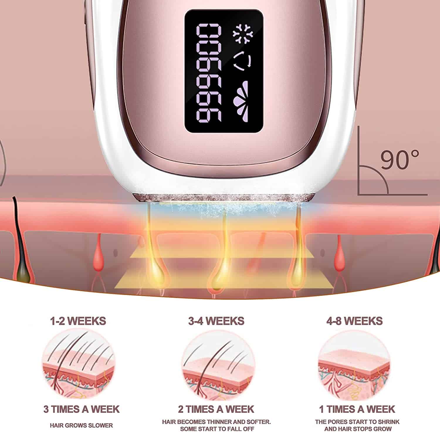 Permanent Hair Removal for Women and Men